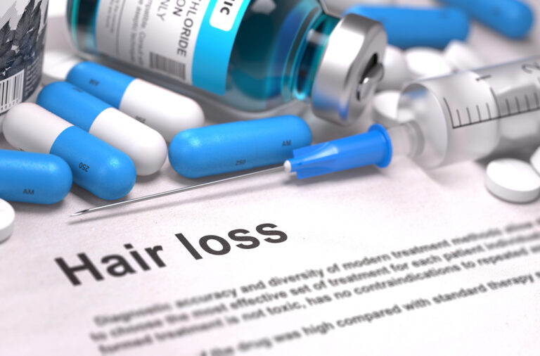 Hair Loss - Medical Concept